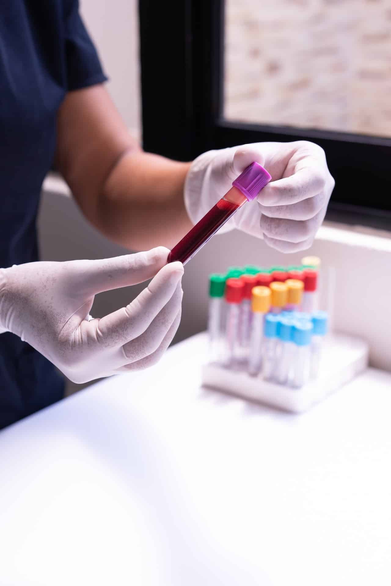 Non-Invasive Prenatal Testing (NIPT) | Professor Asma Khalil